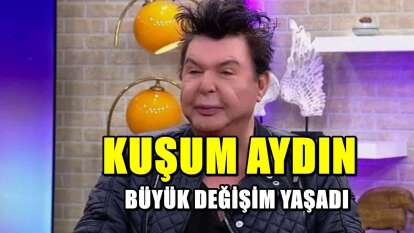 Kuşum Aydın’ın operasyon sonrası son hali! Büyük değişim var