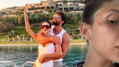 Can Yaman'ın sevgilisi Sara Bluma'dan sarsıcı itiraf: Yüzü mor fotoğrafını paylaşarak isyan etti